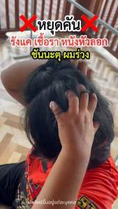 โปรพิเศษ 2 แถม 2 เพียง 580.-แชมพูพญายอ พลูคาว แก้คัน เชื้อรา กลากเกลื้อน ผมร่วง ใช้แล้วปลอดภัย