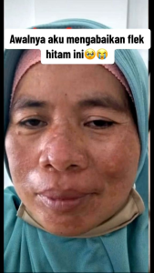 NIGHT CREAM ULTIMATE PLATINUM ORLIN BEAUTY KRIM MALAM FLEK NIGHT CREAM FLEK