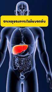 เลซิติน บำรุงตับ กิฟฟารีน Lecithin Giffarine ผสมแคโรทีนอยด์ และวิตามินอี เลซิตินของแท้ กิฟฟารีน ส่งไว