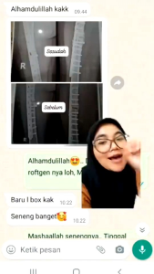 VIRAL DI TIKTOK 100% ORIGINAL BPOM Susu Kalsium Tiens Penyambung Patah Tulang & Retak -Nutrient High Calcium Powder Original 10 Sachet