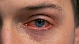 NATURES DROP DIETARY SUPPLEMENT