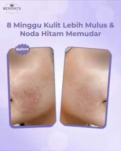 Dark Spot Sunscreen (Exclusive Day Cream) Krim Siang Flek Benings Clinic by dr. Oky Pratama Benings Skincare