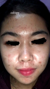 Seri Pemutih Kulit yang Efektif & Aman