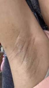 ครีมรักแร้ขาวบายออย🍓สูตรใหม่ แบบซอง (สั่งขั้นต่ำ 3ซองขึ้นไปนะคะ) 29 บาท