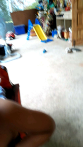 สมุนไพร แก้คัน สะเก็ดเงิน, สะเก็ดทอง, แพ้ปูน, แพ้สารเคมี, แพ้ฝุ่น