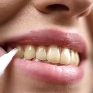 PROMO!! Pemutih Gigi Instan - PEMUTIH GIGI DAZZLING WHITE INSTANT TEETH WHITENING GEL PEN VENEER ARTIS