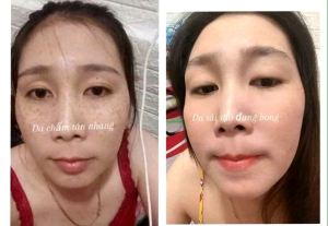 Thảo dược tái tạo da Nhân Sâm 100ml bong nám mụn thâm tàn nhang sau tái sinh da trắng sáng mịn màng mờ sẹo rỗ chai 100ml