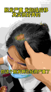 Promo*WOWO Pure Ginger Shampoo
