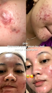 PAKET GOLD SERIES DAVIENA SKINCARE BPOM ORIGINAL
