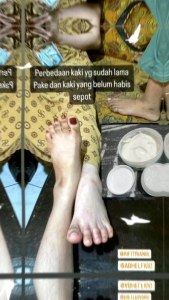 Bibit Whitening Boster 5× Lebih Cepat Mencerahkan Kulit Badan