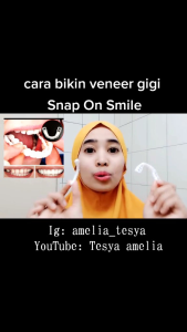 Gigi Palsu Atas Dan Bawah 100% Original Snap On Smile Viner Gigi Instan 1 Set