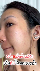 (Newแบนรด์)ครีมรีจูรัน(ซื้อ1แถม1)