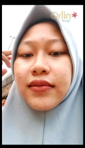 Orlin Day Cream Flek Platinum / Krim Siang Flek Bpom Membantu Memudarkan Flek Spf 50