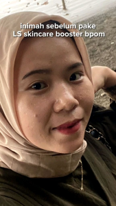 LS SKINCARE PAKET CREAM SIANG & MALAM CREAM WAJAH NEW BRIGHTENING BOOTER GLOWING DALAM 3 HARI