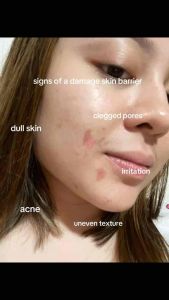 JSkin HydraMoist + Moisture & Barrier Booster Cream 50mL | Moisturizer Cream Barrier Repair