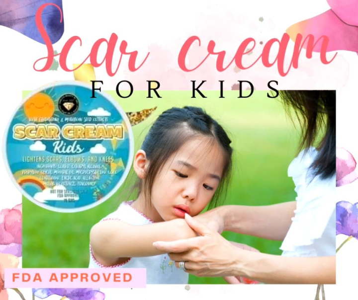 SCAR CREAM FOR KIDS lightening scar peklat remover cream 10g. Lazada PH