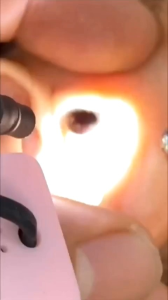 1 đèn led đeo ngón tay gắn cổ taykhông tim đenhỗ trợ nhìn sâu dễ lấy ráy tai ngành ráy tai