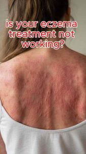 Miracle manuka steven island potent skin healing