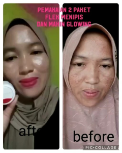 Perawatan Kulit Sehari-hari dengan Skincare Astrid Glows