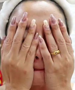 Dr.Manila Serum တင်းတိပ်အမဲ စက်ပျောက်ဆေး အတုအပသတိပြုပါ 🤍