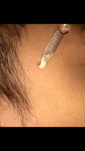 NICOR Krim Anti Penuaan Cream Penghilang Bekas Jerawat pembersih pelembab wajah