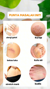 SABUN BULUS HERBAL SR12 SABUN GATAL GATAL SABUN MENCERAHKAN MENGHALUSKAN MELEMBABKAN KULIT HERBAL BPOM