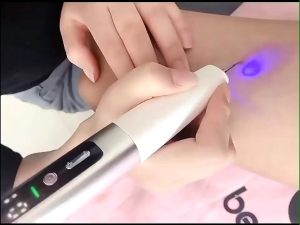 ปากกาจี้ไฝคุณภาพสูงปรับไฟ15ระดับ