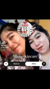 Cream Flek Maxie Ori Garansi Uang Kembali Jika Palsu