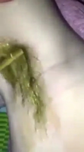 [FreeshipMAX] cobom triệt lông vĩnh viễn was vèo và mỡ trăn