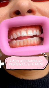 Permata/diamond gigi 350pcs & Lem permata gigi/lem penambal gigi bolong