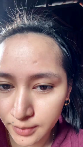 (FLEK SOLUSION) TONER 30ML AMPUH MENGATASI FLEK WAJAH cairan khusus flek