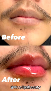 VICO LIP SERUM PEMERAH BIBIR PENCERAH BIBIR ALAMI DAN TERAMPUH 100% ORIGINAL