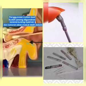 (5IN1 FREE BOX) ALAT PEMBERSIH TELINGA STAINLESS STEEL / KOREK KUPING PER SET / EAR WAX / KKP5722
