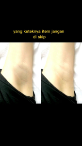 PENCERAH KETIAK - CREAM PEMUTIH KETIAK - PEMUTIH SELANGKANGAN - PEMUTIH BADAN PERMANEN SHINKURIM