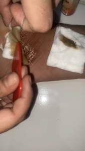 TUMITKU OBAT HERBAL MENGATASI KAKI PECAH PECAH ISI 30ML ORIGINAL BPOM