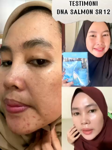 Sepaket Dna Salmon Sr12 Paket Lengkap Glowing Mencerahkan Menyamar kan Flek hitam Cocok untuk semua jenis kulit