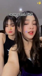 STIKER VIRAL PENUTUP JERAWAT LUCU ACNE PIMPLE PATCH 36PCS