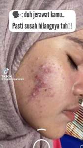 Mantulita skincare paket +sunscreen +skinbooster (isi 6)