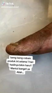 30 ml TUMITKU OBAT KAKI PECAH KAPALAN ORIGINAL BPOM solusi kaki pecah-pecah dan kapalan
