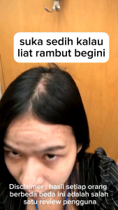 SHAMEA Serum Rambut & Alis: Solusi Penumbuh Rambut Cepat & Efektif