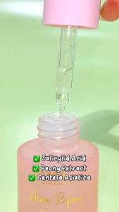 JGLOW SKINCARE - Skin Refine Serum: Solusi untuk Kulit Berminyak & Berjerawat