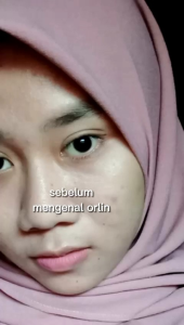 ORLIN PAKET FLEK & SERUM REJENU / PAKET GLOWING PENGHILANG FLEK