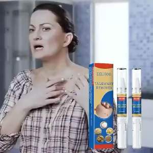 EELHOE SKIN TAG WART REMOVER mole remover corn remover penanggal ketuat kutil tahi lalat bintik hitam