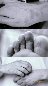 Massage Oil BULUS SR12/Minyak pijat/Mengencangkan