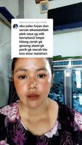 NIACINAMIDE 5% SPOT WHITENING ESSENCE - SERUM PENCERAH & MELENYAPKAN FLEK WAJAH Ukuran: 15ml | Formula ringan cepat meresap dan efektif