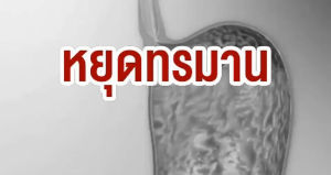 Sea buckthorn กรดไหลย้อนโรคยอดฮิต ปวดแสบปวดร้อนกลางอก อันตรายกว่าที่คิด