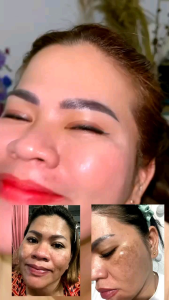 GOLD JELLY ORI KEDAS BEAUTY