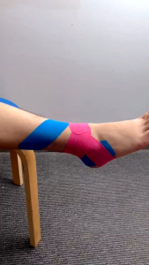 Kineso Tape Tapping Kinesiology Tape 5CM X 25M Teping Olahraga Taping Perban Elastis