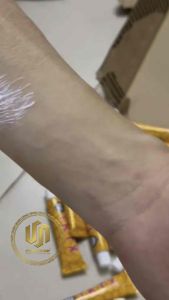 Combo 10 tuýp tktx vàng bọ cạp jpro