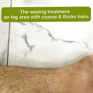 COLD WAX HAIR REMOVAL FOR FACE & BODY 💯 GUARANTEE EFECTIVE FAST RESULT STOCK} COLD WAX HAIR REMOVAL 100% EFFECTIVE